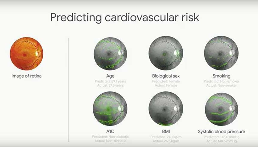 Predicting Cardiovascular Risk